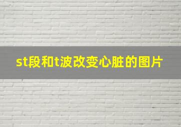 st段和t波改变心脏的图片