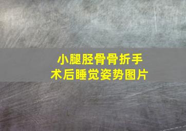 小腿胫骨骨折手术后睡觉姿势图片