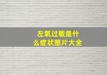 左氧过敏是什么症状图片大全