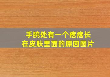 手腕处有一个疙瘩长在皮肤里面的原因图片