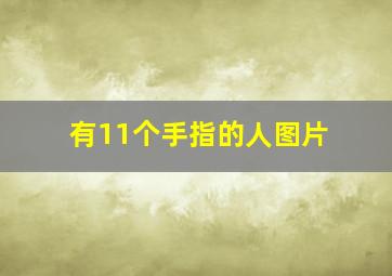 有11个手指的人图片