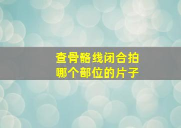 查骨骼线闭合拍哪个部位的片子