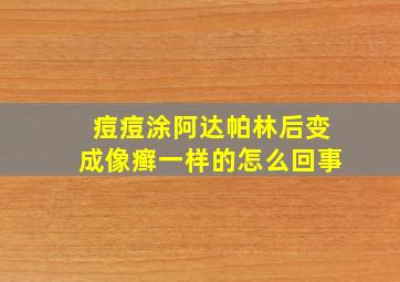 痘痘涂阿达帕林后变成像癣一样的怎么回事