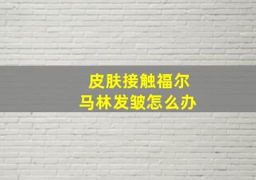 皮肤接触福尔马林发皱怎么办