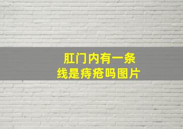 肛门内有一条线是痔疮吗图片