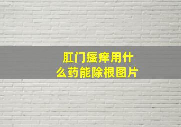 肛门瘙痒用什么药能除根图片