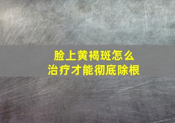 脸上黄褐斑怎么治疗才能彻底除根