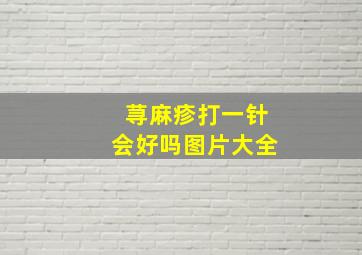 荨麻疹打一针会好吗图片大全