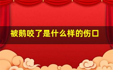 被鹅咬了是什么样的伤口